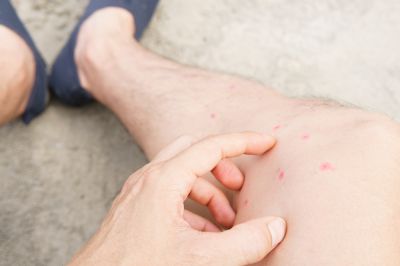 Get Fleas Fumigated from Your Home!